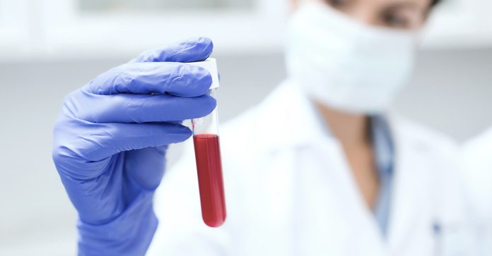 Blood Analysis Melbourne