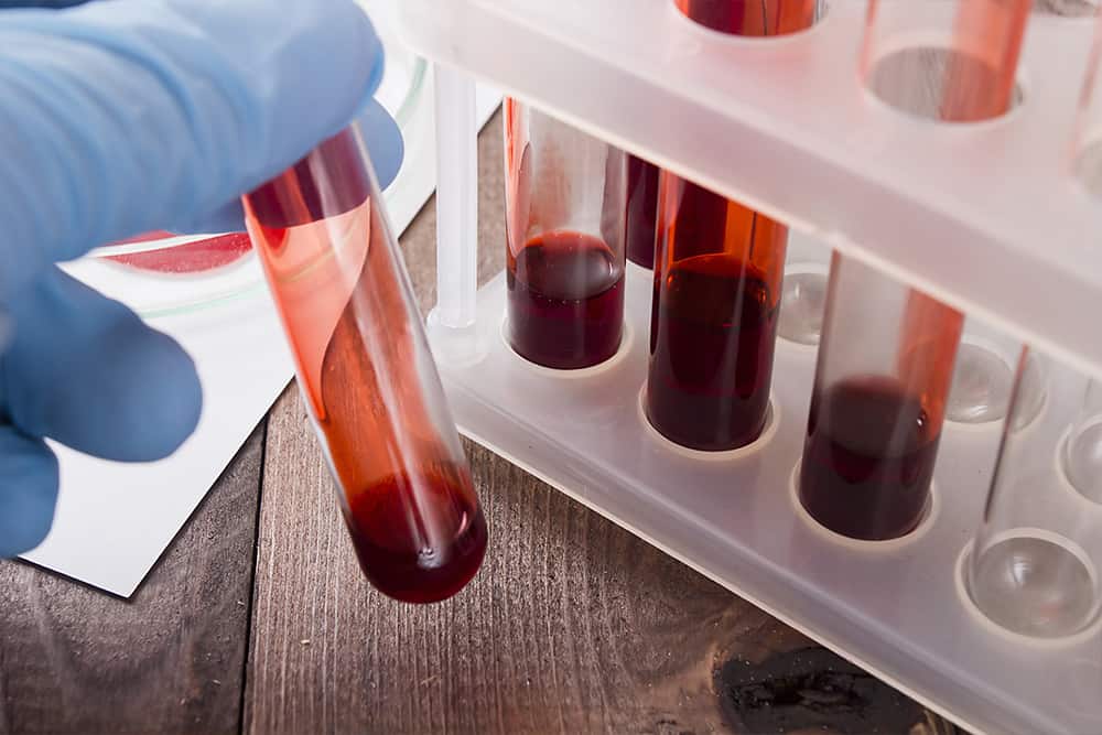 Blood analysis Melbourne