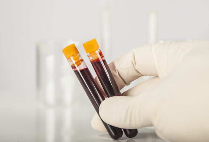 Blood analysis Melbourne