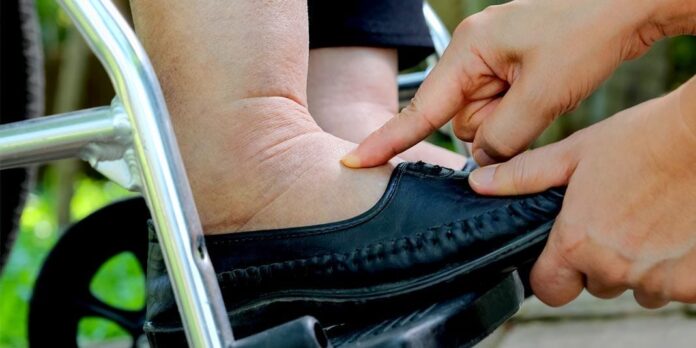 Shoes for Fat Swollen Feet
