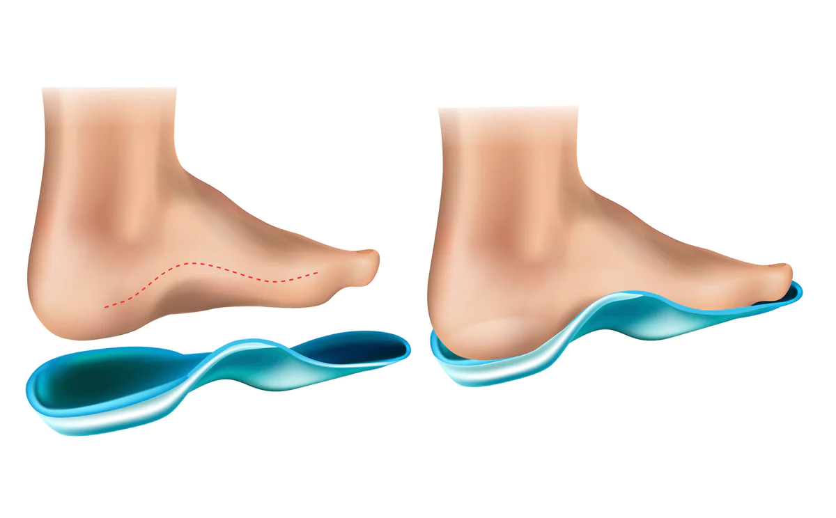  high arch high instep